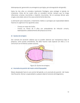 70
balanoprepucial, generando una emergencia quirúrgica, por estrangulación del glande).
Hasta los dos años se considera totalmente fisiológico, para proteger el glande de
irritaciones. Antes de los cuatro años se considera normal, siempre que no tenga
infecciones urinarias recurrentes o balanitis recurrentes. No se aconseja derivar para
cirugía a esta edad, salvo en los casos anteriormente descritos.
La derivación para evaluación y tratamiento médico o quirúrgico por especialidad deberá
hacerse sin urgencia en los siguientes casos:
- Fimosis en mayor de 4 años
- Fimosis en menor de 4 años con antecedentes de infección urinaria,
balanopostitis o abalonamiento del prepucio al orinar.
d) Quistes de esmegma
Son cúmulos de secreción sebácea que se pueden observar por transparencia bajo el
prepucio, como quistes amarillentos. No debe hacerse nada especial con ellos y si se
comunican con el exterior pueden vaciarse.
e) Anomalías de posición del meato uretral (hipospadia)
Meato desplazado hacia la cara ventral del glande, es la anomalía de posición del meato
más frecuente. Derivar a especialidad a cualquier edad al momento del diagnóstico.
Figura 33: Quiste de esmegma
 