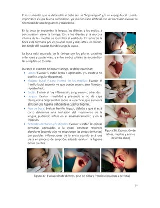 74
El instrumental que se debe utilizar debe ser un “baja lengua” y/o un espejo bucal. Lo más
importante es una buena iluminación, ya sea natural o artificial. De ser necesario evaluar la
necesidad de uso de guantes y mascarilla.
En la boca se encuentra la lengua, los dientes y las encías, a
continuación viene la faringe. Entre los dientes y la mucosa
interna de las mejillas se identifica el vestíbulo. El techo de la
boca está formada por el paladar duro y más atrás, el blando.
Del borde del paladar blando cuelga la úvula.
La boca está separada de la faringe por los pilares palatinos
anteriores y posteriores, y entre ambos pilares se encuentran
las amígdalas o tonsilas.
Durante el examen de boca y faringe, se debe examinar:
 Labios: Evaluar si están secos o agrietados, y si existe o no
queilitis angular (boqueras).
 Mucosa bucal y cara interna de las mejillas: Evaluar el
frenillo labial superior ya que puede encontrarse fibroso o
hipertrofiado.
 Encías: Evaluar si hay inflamación, sangramiento o heridas.
 Lengua: Evaluar movilidad y presencia o no de capa
blanquecina desprendible sobre la superficie, que aumenta
al haber una higiene deficiente o cuadros febriles.
 Piso de boca: Evaluar frenillo lingual, debido a que si está
corto determina una limitación del movimiento de la
lengua, pudiendo influir en el amamantamiento y en la
fonación.
 Rebordes dentarios y/o dientes: Evaluar si están las piezas
dentarias adecuadas a la edad, observar rebordes
alveolares (cuando aún no erupcionan las piezas dentarias)
por posibles inflamaciones de la encía cuando está una
pieza en proceso de erupción, además evaluar la higiene
de los dientes.
Figura 36: Evaluación de
labios, mejillas y encías
(de arriba abajo)
Figura 37: Evaluación de dientes, piso de boca y frenillos (izquierda a derecha)
 