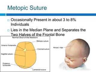 Metopic Ridge Normal Vs Metopic Ridge Norma Verticalis | PPTX