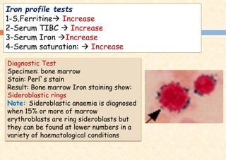 Iron profile tests
1-S.Ferritine→ Increase
2-Serum TIBC → Increase
3-Serum Iron →Increase
4-Serum saturation: → Increase
Diagnostic Test
Specimen: bone marrow
Stain: Perl`s stain
Result: Bone marrow Iron staining show:
Sideroblastic rings
Note: Sideroblastic anaemia is diagnosed
when 15% or more of marrow
erythroblasts are ring sideroblasts but
they can be found at lower numbers in a
variety of haematological conditions
 