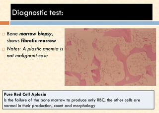 Diagnostic test:
 Bone marrow biopsy,
shows fibrotic marrow
 Notes: A plastic anemia is
not malignant case
Pure Red Cell Aplasia
Is the failure of the bone marrow to produce only RBC, the other cells are
normal in their production, count and morphology
 