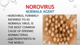 Norovirus -Norwalk agent | PPTX