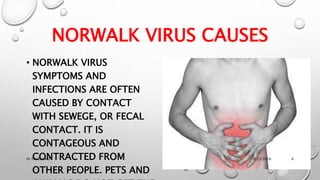 Norwalk Virus Symptoms