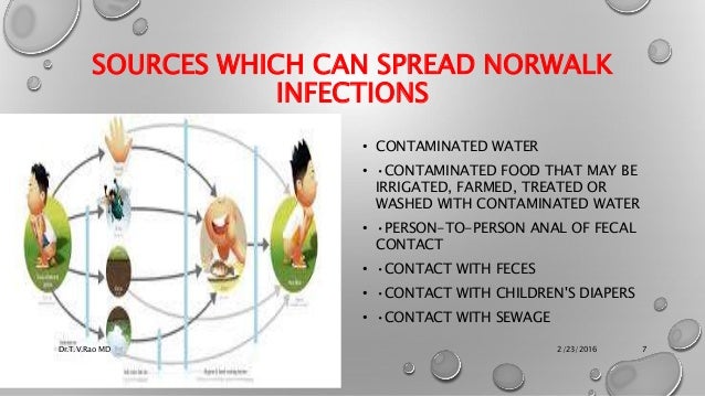 Norovirus -Norwalk agent