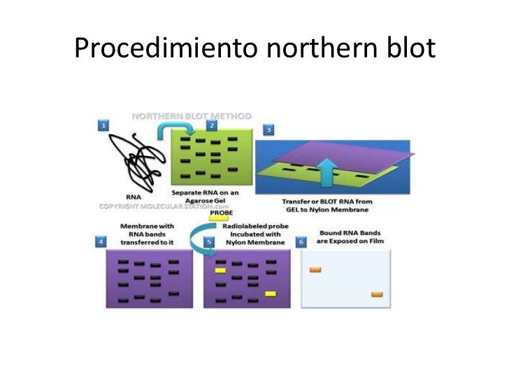 Diferencia Entre Southern Blot Y Northern Blot