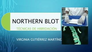NORTHERN BLOT
TÉCNICAS DE HIBRIDACIÓN
VIRGINIA GUTIÉRREZ MARTÍNEZ
 
