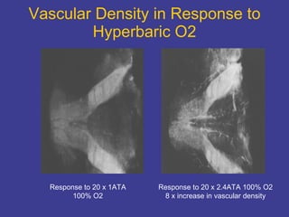 Vascular Density in Response to Hyperbaric O2 Response to 20 x 1ATA 100% O2 Response to 20 x 2.4ATA 100% O2 8 x increase in vascular density 