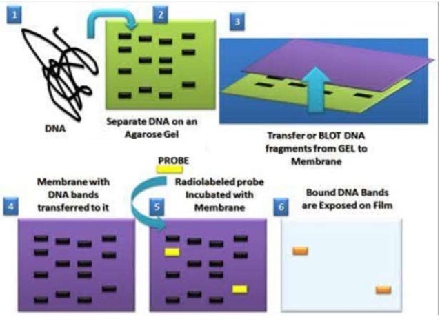 Diferencia Entre Southern Blot Y Northern Blot