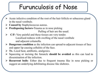 Nose anatomy and physiology | PPTX
