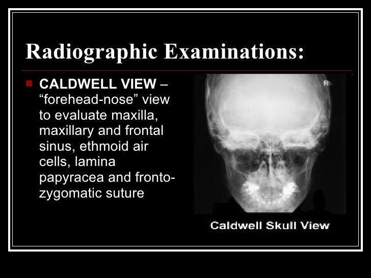 Nose and paranasal sinuses