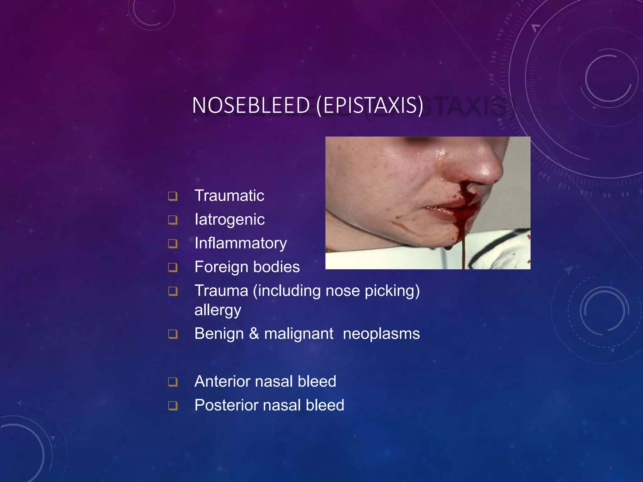 Nose and para nasal sinus meher | PPTX