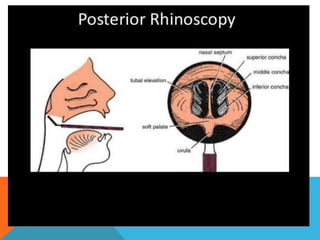 Nose examination ppt | PPTX