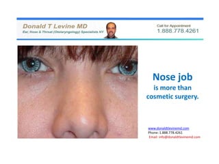 Nose job
  is more than
cosmetic surgery.



www.donaldtlevinemd.com
Phone: 1.888.778.4261
Email: info@donaldtlevinemd.com
 