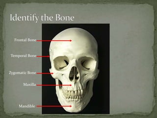 Mandible
Maxilla
Zygomatic Bone
Temporal Bone
Frontal Bone
 