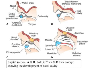Frontal Sinus Development nose, paranasal sinus and pharynx dev't.pptx