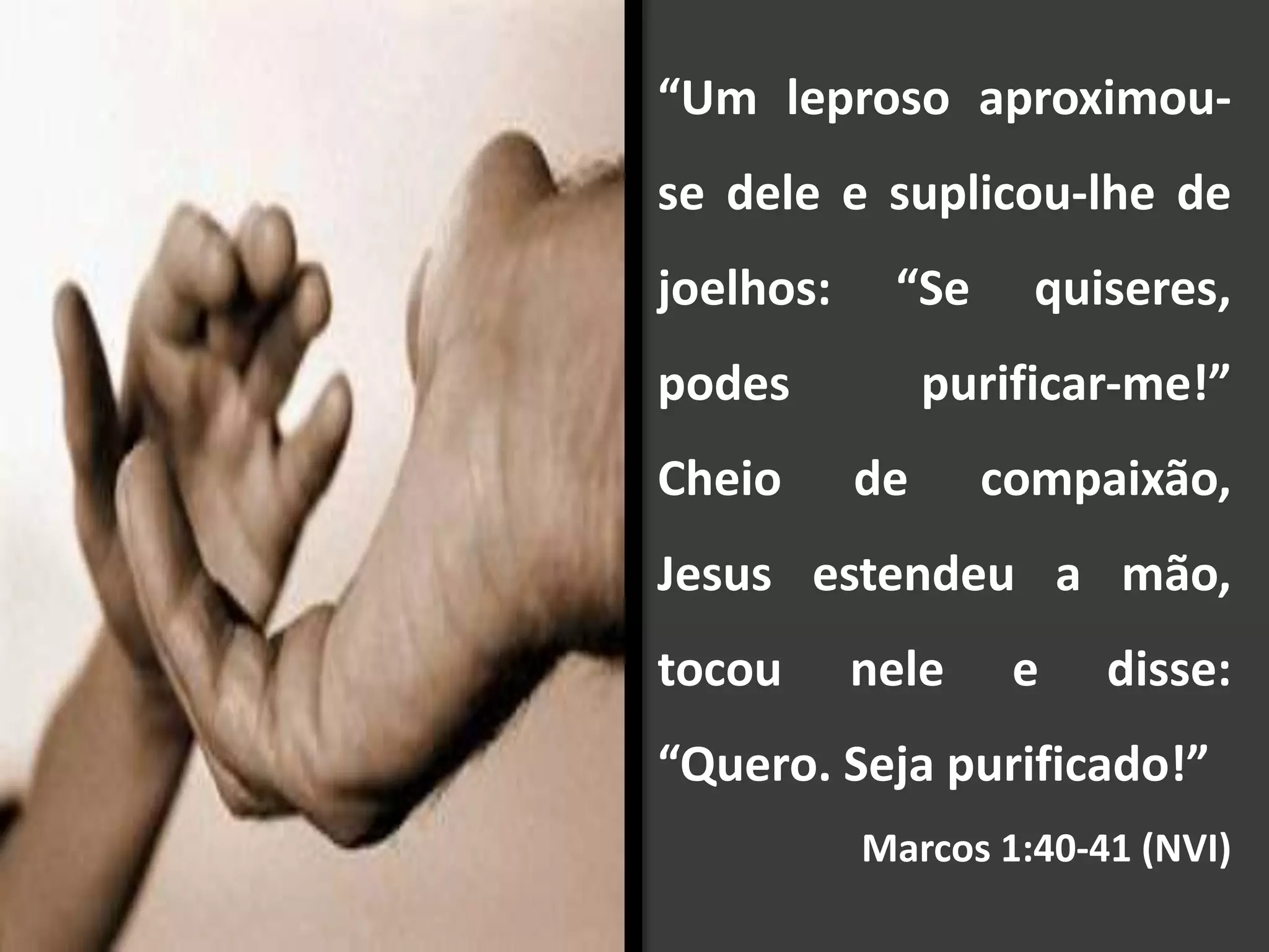 “Um leproso aproximou-
se dele e suplicou-lhe de
joelhos: “Se quiseres,
podes purificar-me!”
Cheio de compaixão,
Jesus estendeu a mão,
tocou nele e disse:
“Quero. Seja purificado!”
Marcos 1:40-41 (NVI)
 