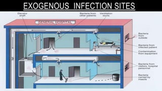 EXOGENOUS INFECTION SITES
 