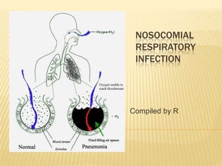 NOSOCOMIAL RESPIRATORY INFECTION Compiled by R 