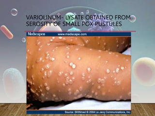 VARIOLINUM- LYSATE OBTAINED FROM
SEROSITY OF SMALL POX PUSTULES
 