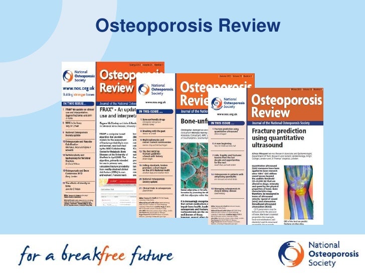 NOS_Osteoporosis and Bone Conference 2012 session ppt