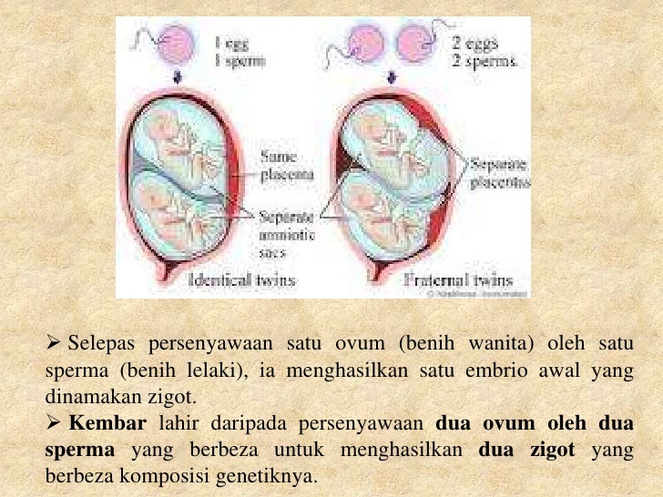 Pembentukkan kembar seiras dan tak seiras