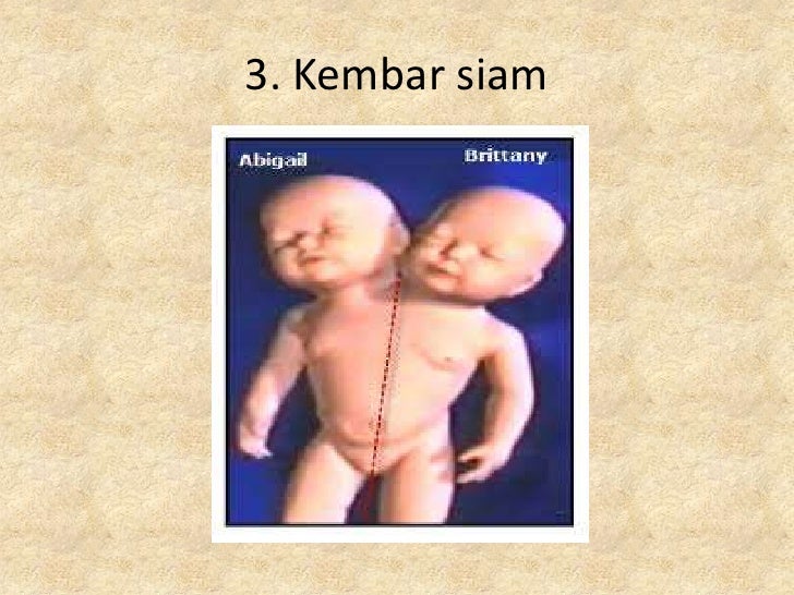 Pembentukkan Kembar Seiras Dan Tak Seiras