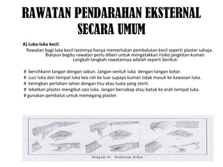 RAWATAN PENDARAHAN EKSTERNAL
SECARA UMUM
A) Luka-luka kecil.
Rawatan bagi luka kecil lazimnya hanya memerlukan pembalutan kecil seperti plaster sahaja.
Biarpun begitu rawatan perlu diberi untuk mengelakkan risiko jangkitan kuman.
Langkah-langkah rawatannya adalah seperti berikut:
# bersihkann tangan dengan sabun. Jangan sentuh luka dengan tangan kotor.
# cuci luka dari tempat luka kea rah ke luar supaya kuman tidak masuk ke kawasan luka.
# keringkan perlahan-lahan dengan tisu atau tuala yang steril.
# lekatkan plaster mengikut saiz luka. Jangan bercakap atau batuk ke arah tempat luka.
# gunakan pembalut untuk memegang plaster.
 