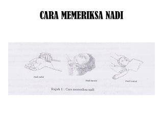 CARA MEMERIKSA NADI
 