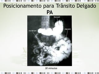 Posicionamento para Trânsito Delgado
PA
30 minutos
 
