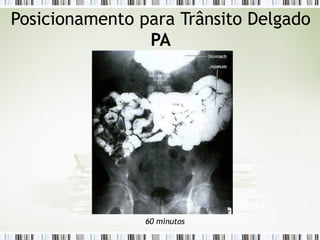 Posicionamento para Trânsito Delgado
PA
60 minutos
 