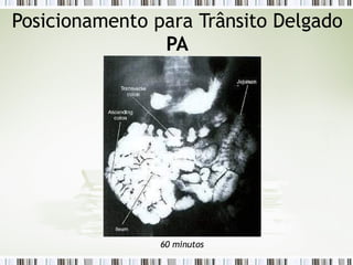 Posicionamento para Trânsito Delgado
PA
60 minutos
 