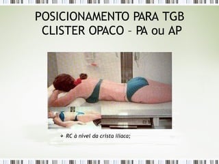 POSICIONAMENTO PARA TGB
CLISTER OPACO – PA ou AP
RC à nível da crista ilíaca;
 