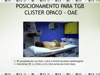 POSICIONAMENTO PARA TGB
CLISTER OPACO - OAE
RC perpendicular ao filme, 2,5cm à direita do plano mediossagital.
Centralizar RC e o filme a 2,5 a 5cm acima da crista ilíaca.
 