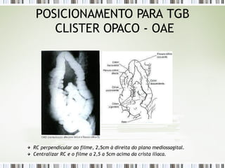 POSICIONAMENTO PARA TGB
CLISTER OPACO - OAE
RC perpendicular ao filme, 2,5cm à direita do plano mediossagital.
Centralizar RC e o filme a 2,5 a 5cm acima da crista ilíaca.
 