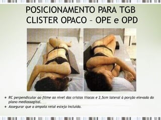 POSICIONAMENTO PARA TGB
CLISTER OPACO – OPE e OPD
RC perpendicular ao filme ao nível das cristas ilíacas e 2,5cm lateral à porção elevada do
plano mediossagital.
Assegurar que a ampola retaI esteja incluída.
 