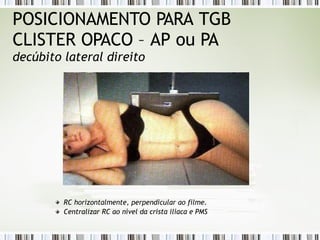 POSICIONAMENTO PARA TGB
CLISTER OPACO – AP ou PA
decúbito lateral direito
RC horizontalmente, perpendicular ao filme.
Centralizar RC ao nível da crista ilíaca e PMS
 