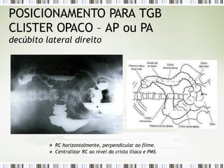 POSICIONAMENTO PARA TGB
CLISTER OPACO – AP ou PA
decúbito lateral direito
RC horizontalmente, perpendicular ao filme.
Centralizar RC ao nível da crista ilíaca e PMS
 