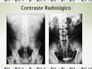 Contraste Radiológico
 