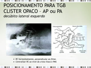 POSICIONAMENTO PARA TGB
CLISTER OPACO – AP ou PA
decúbito lateral esquerdo
RC horizontalmente, perpendicular ao filme.
Centralizar RC ao nível da crista ilíaca e PMS
 