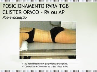 POSICIONAMENTO PARA TGB
CLISTER OPACO – PA ou AP
Pós-evacuação
RC horizontalmente, perpendicular ao filme.
Centralizar RC ao nível da crista ilíaca e PMS
 