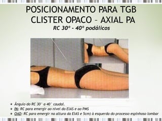 POSICIONAMENTO PARA TGB
CLISTER OPACO – AXIAL PA
RC 30º - 40º podálicos
Ângulo do RC 30° a 40° caudal.
PA: RC para emergir ao nível do ElAS e ao PMS
OAD: RC para emergir na altura da ElAS e 5cm) à esquerda do processo espinhoso lombar
 