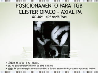 POSICIONAMENTO PARA TGB
CLISTER OPACO – AXIAL PA
RC 30º - 40º podálicos
Ângulo do RC 30° a 40° caudal.
PA: RC para emergir ao nível do ElAS e ao PMS
OAD: RC para emergir na altura da ElAS e 5cm) à esquerda do processo espinhoso lombar
 
