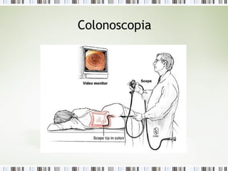 Colonoscopia
 