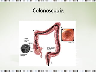 Colonoscopia
 