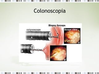 Colonoscopia
 