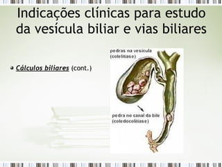Cálculos biliares (cont.)
Indicações clínicas para estudo
da vesícula biliar e vias biliares
 