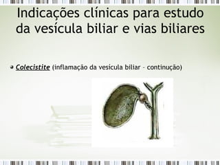 Colecistite (inflamação da vesícula biliar – continução)
Indicações clínicas para estudo
da vesícula biliar e vias biliares
 