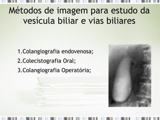 1.Colangiografia endovenosa;
2.Colecistografia Oral;
3.Colangiografia Operatória;
Métodos de imagem para estudo da
vesícula biliar e vias biliares
 