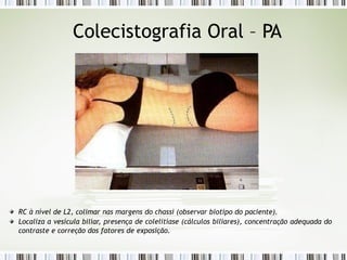 Colecistografia Oral – PA
RC à nível de L2, colimar nas margens do chassi (observar biotipo do paciente).
Localiza a vesícula biliar, presença de colelitíase (cálculos biliares), concentração adequada do
contraste e correção dos fatores de exposição.
 