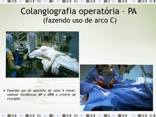 Colangiografia operatória – PA
(fazendo uso de arco C)
Fazendo uso de aparelho de raios X móvel,
realizar incidências AP e OPD a critério do
cirurgião.
 